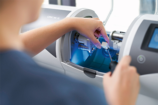 秩父郡・おこのぎ歯科医院・セレックシステムのメリット